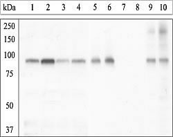 Phospho-GYS1 (Ser641, Ser645) Antibody in Western Blot (WB)