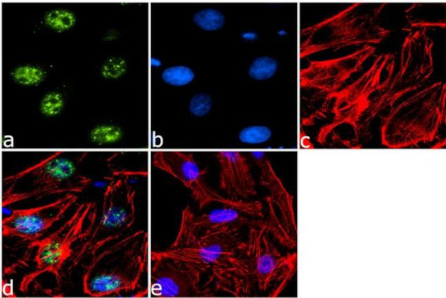 Phospho-ETS2 (Thr72) Antibody in Immunocytochemistry (ICC/IF)