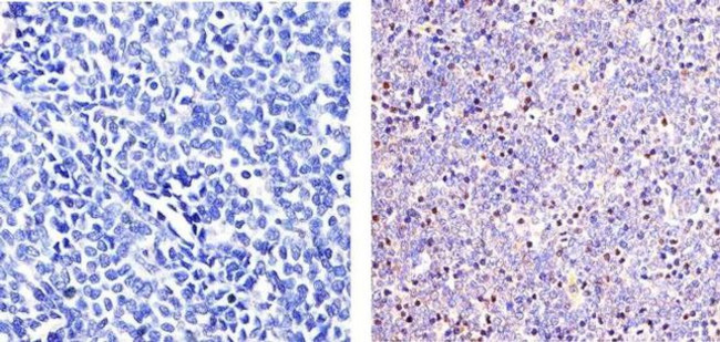 Phospho-ETS2 (Thr72) Antibody in Immunohistochemistry (Paraffin) (IHC (P))