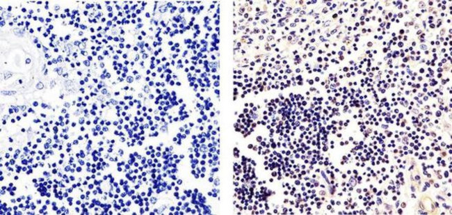 Phospho-ETS2 (Thr72) Antibody in Immunohistochemistry (Paraffin) (IHC (P))