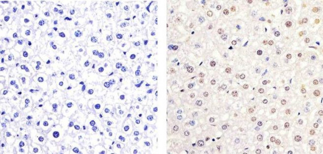 Phospho-ETS2 (Thr72) Antibody in Immunohistochemistry (Paraffin) (IHC (P))