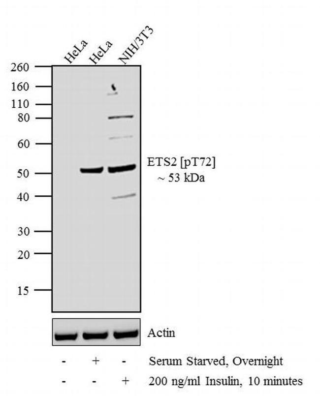 Phospho-ETS2 (Thr72) Antibody in Western Blot (WB)