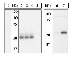 Phospho-ETS1 (Ser251) Antibody in Western Blot (WB)