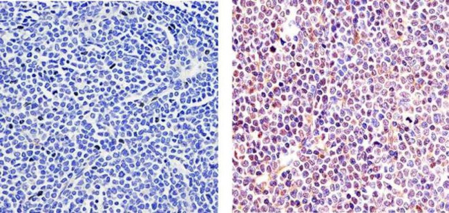 Phospho-ETS1 (Ser282, Ser285) Antibody in Immunohistochemistry (Paraffin) (IHC (P))