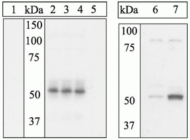 Phospho-ETS1 (Ser282, Ser285) Antibody