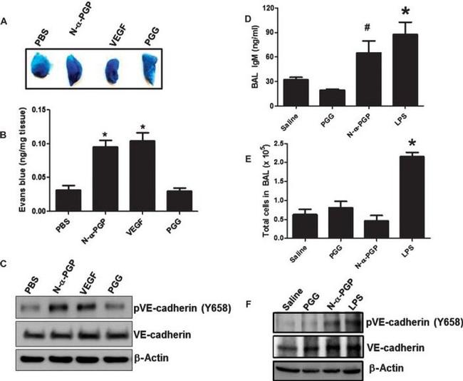 Phospho-VE-cadherin (Tyr658) Antibody in Western Blot (WB)