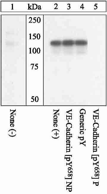 Phospho-VE-cadherin (Tyr658) Antibody in Western Blot (WB)