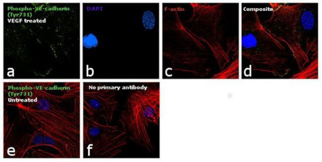 Phospho-VE-cadherin (Tyr731) Antibody in Immunocytochemistry (ICC/IF)