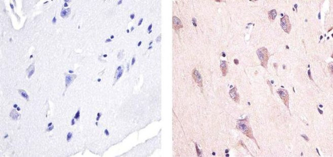 Phospho-AMPK alpha-1,2 (Thr183, Thr172) Antibody in Immunohistochemistry (Paraffin) (IHC (P))