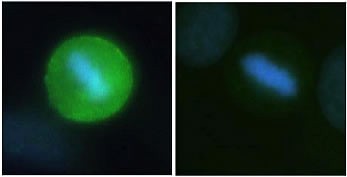 Phospho-PPP1R2 (Thr72) Antibody in Immunocytochemistry (ICC/IF)