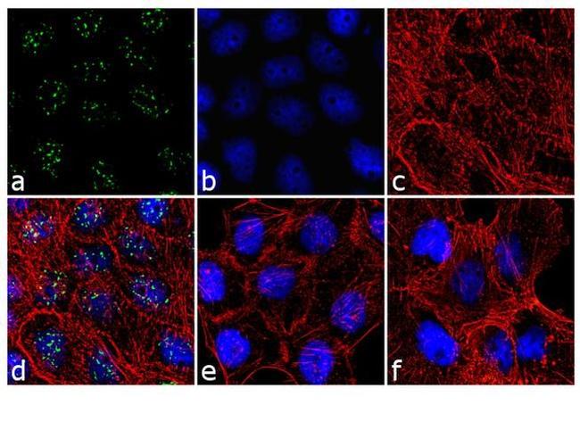 Phospho-PPP1R2 (Thr72) Antibody