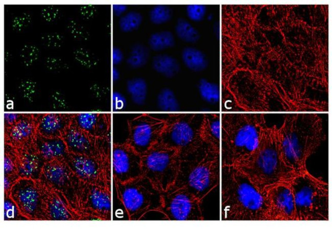 Phospho-PPP1R2 (Thr72) Antibody in Immunocytochemistry (ICC/IF)