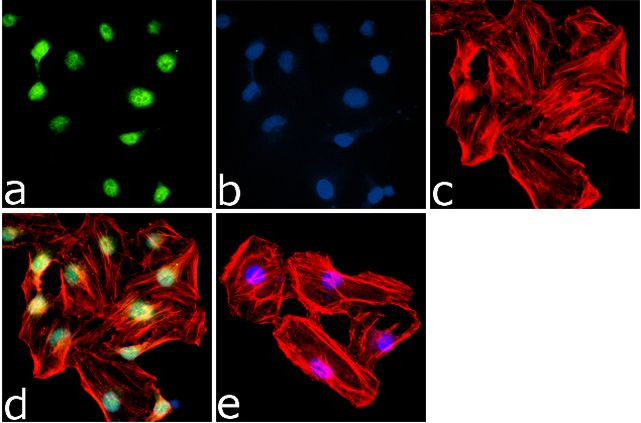 Phospho-4EBP1 (Thr46) Antibody in Immunocytochemistry (ICC/IF)