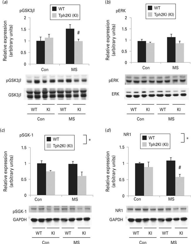 Phospho-SGK1 (Thr256) Antibody in Western Blot (WB)