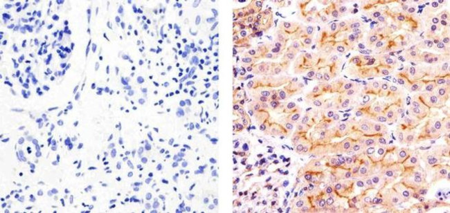 Phospho-SGK1 (Thr256) Antibody in Immunohistochemistry (Paraffin) (IHC (P))