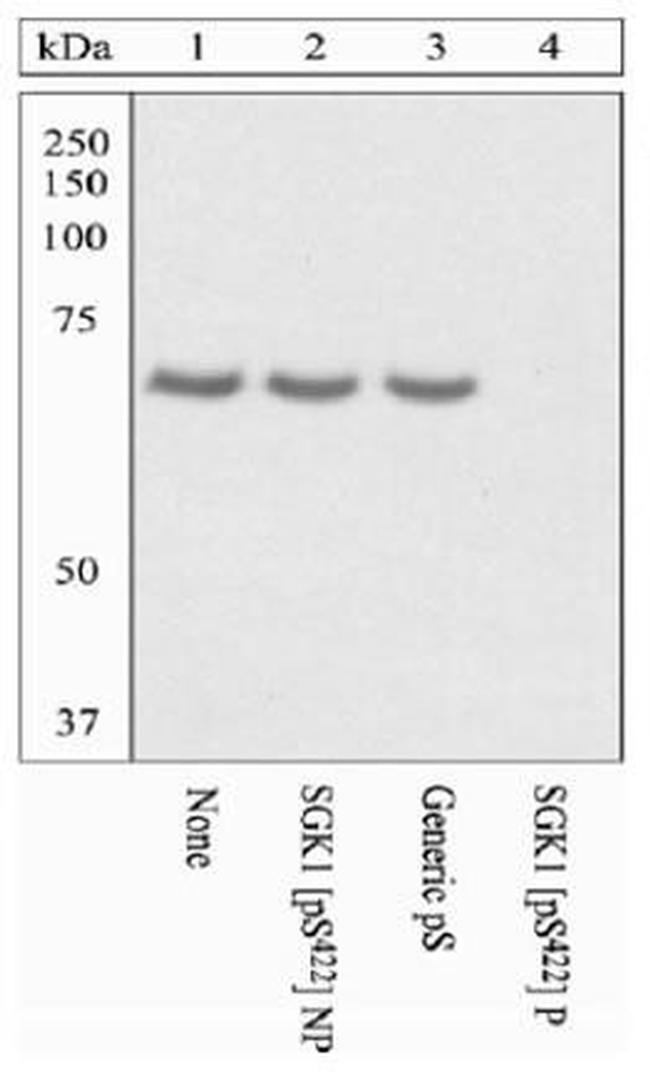 Phospho-SGK1 (Ser422) Antibody in Western Blot (WB)