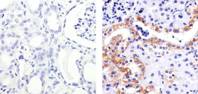 Phospho-SGK1 (Ser422) Antibody in Immunohistochemistry (Paraffin) (IHC (P))