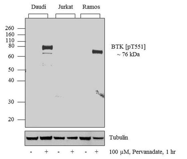 Phospho-Btk (Tyr551) Antibody in Western Blot (WB)