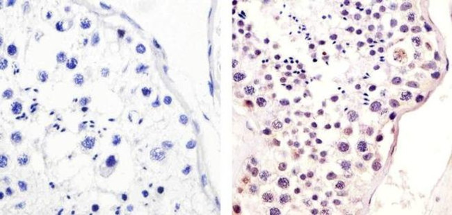 Phospho-MDM2 (Ser166) Antibody in Immunohistochemistry (Paraffin) (IHC (P))