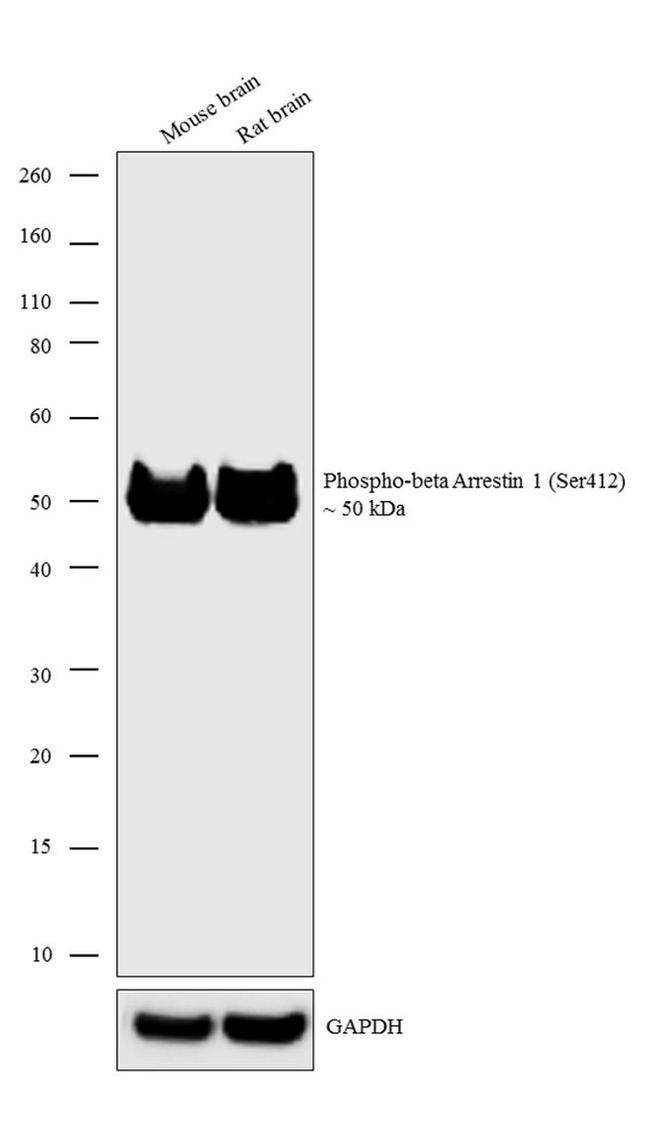 Phospho-beta Arrestin 1 (Ser412) Antibody in Western Blot (WB)