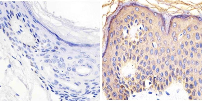 Phospho-RAC1/CDC42 (Ser71) Antibody in Immunohistochemistry (Paraffin) (IHC (P))