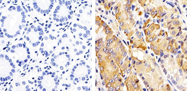 Phospho-RAC1/CDC42 (Ser71) Antibody in Immunohistochemistry (Paraffin) (IHC (P))