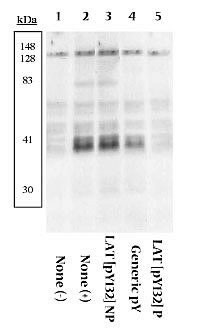 Phospho-LAT (Tyr132) Antibody in Western Blot (WB)