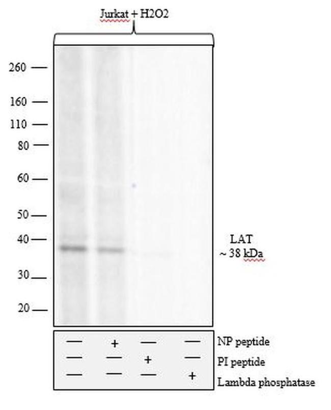 Phospho-LAT (Tyr191) Antibody in Western Blot (WB)