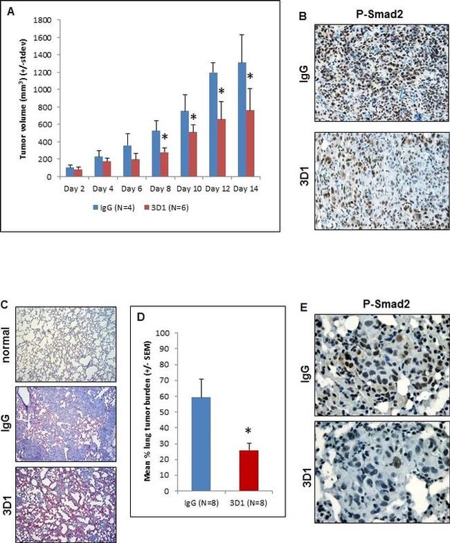 Phospho-SMAD2 (Ser465, Ser467) Antibody in Immunohistochemistry (IHC)