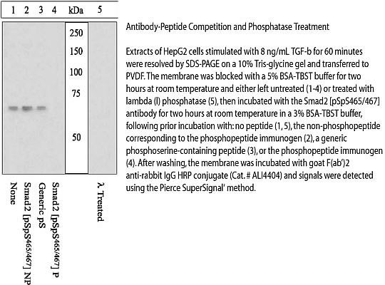 Phospho-SMAD2 (Ser465, Ser467) Antibody in Western Blot (WB)