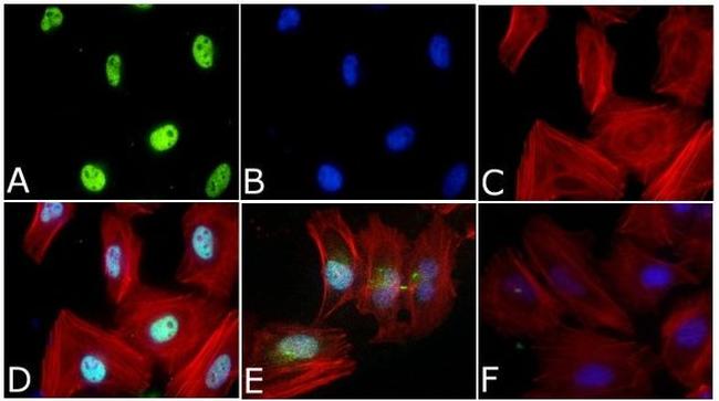 Phospho-SMAD2 (Ser465, Ser467) Antibody