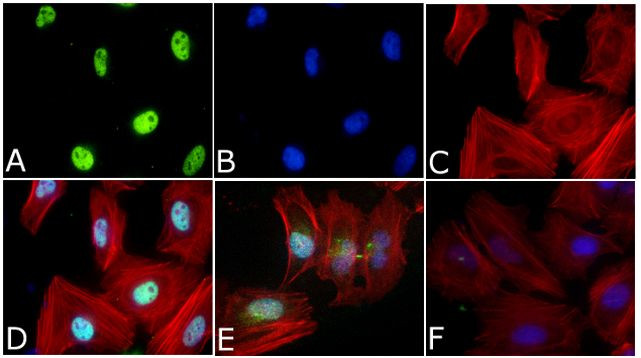 Phospho-SMAD2 (Ser465, Ser467) Antibody in Immunocytochemistry (ICC/IF)