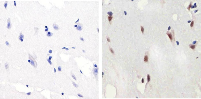 Phospho-SMAD2 (Ser465, Ser467) Antibody in Immunohistochemistry (Paraffin) (IHC (P))