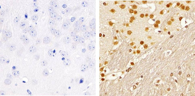 Phospho-SMAD2 (Ser465, Ser467) Antibody in Immunohistochemistry (Paraffin) (IHC (P))