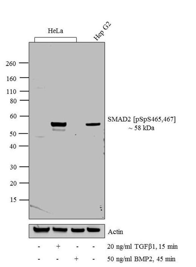 Phospho-SMAD2 (Ser465, Ser467) Antibody in Western Blot (WB)