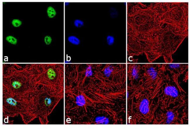 Phospho-c-Fos (Thr232) Antibody in Immunocytochemistry (ICC/IF)