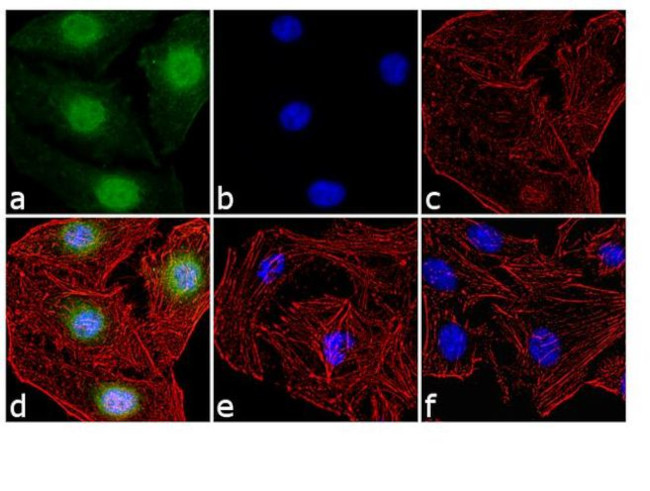 Phospho-c-Fos (Thr325) Antibody in Immunocytochemistry (ICC/IF)