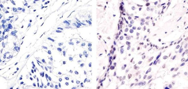 Phospho-ATF2 (Thr71) Antibody in Immunohistochemistry (Paraffin) (IHC (P))