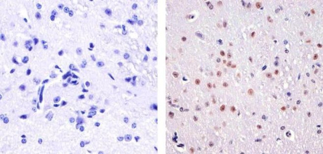 Phospho-ATF2 (Thr71) Antibody in Immunohistochemistry (Paraffin) (IHC (P))