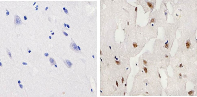 Phospho-CREB (Ser133) Antibody in Immunohistochemistry (Paraffin) (IHC (P))