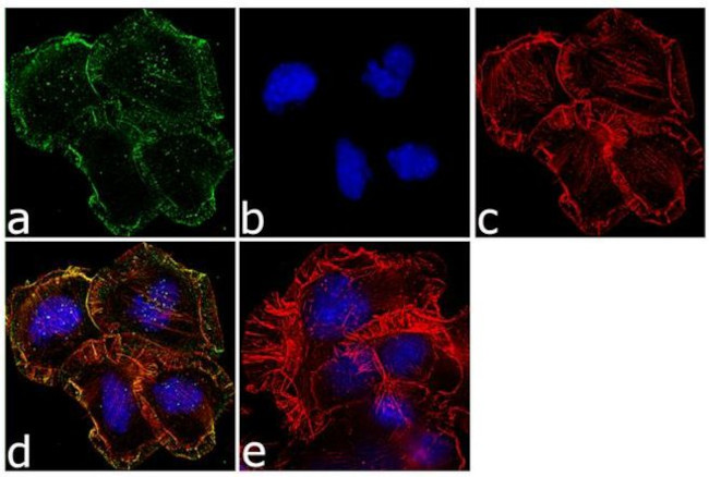 OPRM1 Antibody in Immunocytochemistry (ICC/IF)