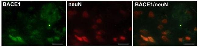 beta Amyloid (1-42) Antibody in Immunohistochemistry (Paraffin) (IHC (P))