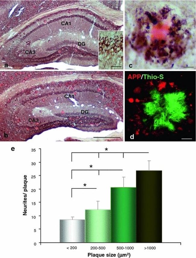 beta Amyloid (1-42) Antibody in Immunohistochemistry (IHC)