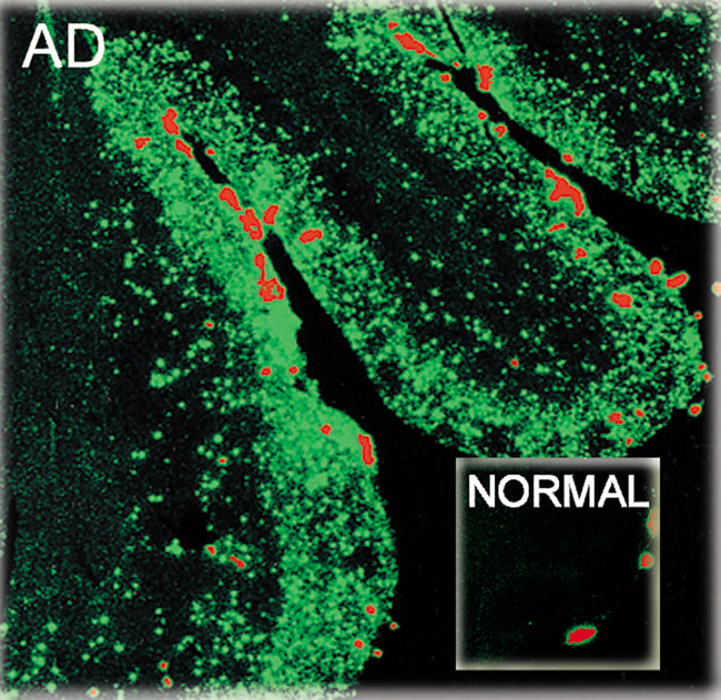 beta Amyloid (1-40) Antibody in Immunohistochemistry (IHC)