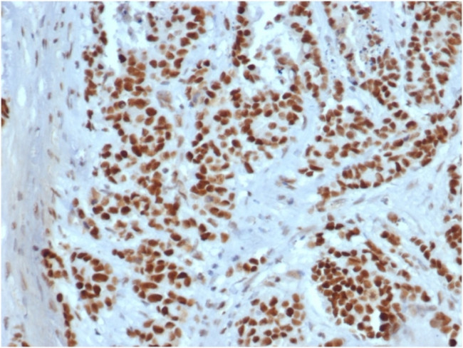 MSH2 Antibody in Immunohistochemistry (Paraffin) (IHC (P))