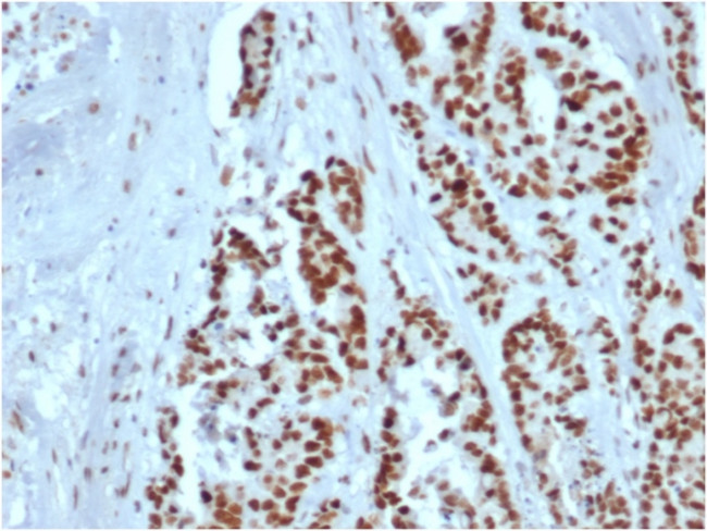 MSH2 Antibody in Immunohistochemistry (Paraffin) (IHC (P))