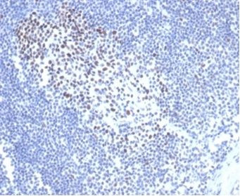 MSH2 Antibody in Immunohistochemistry (Paraffin) (IHC (P))