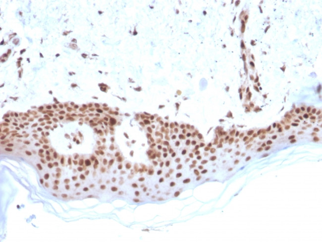 MSH2 Antibody in Immunohistochemistry (Paraffin) (IHC (P))