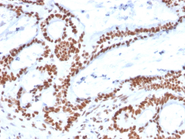 MSH2 Antibody in Immunohistochemistry (Paraffin) (IHC (P))