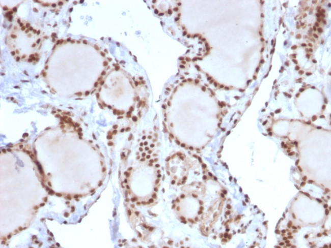 MSH2 Antibody in Immunohistochemistry (Paraffin) (IHC (P))